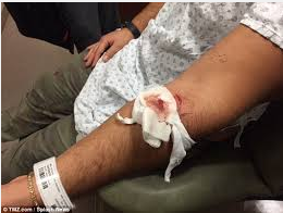 Drone slices mans arm.png
